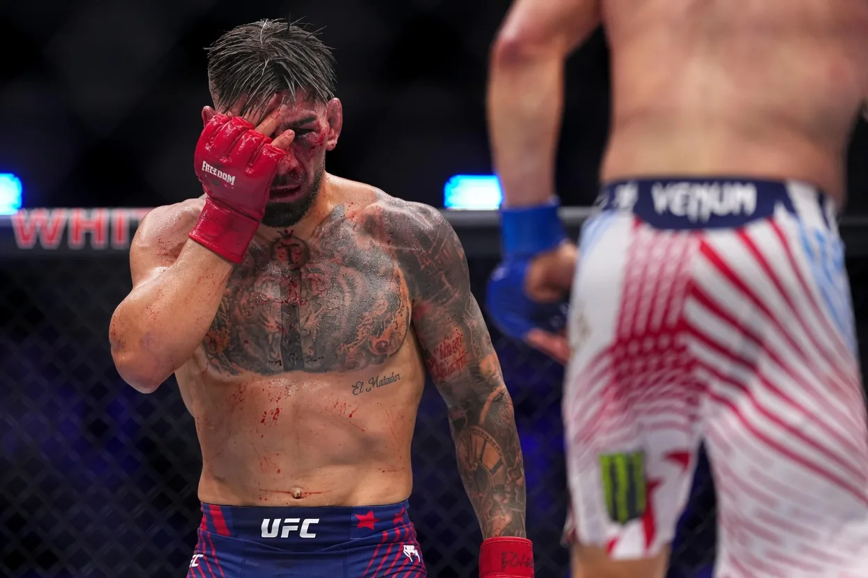 Ilia Topuria Tras la Derrota: El Estado de Salud del Matador y la Reacción que Sorprendió a Todos